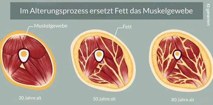 Die Anwendung einer Vibrationsplatte bei Sarkopenie