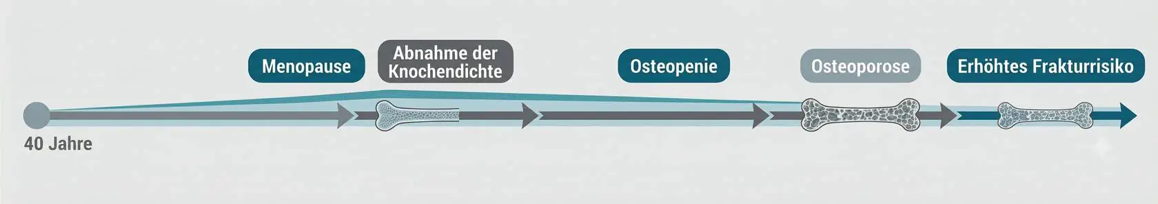 Die Stufen und Entwicklung der Osteoporose
