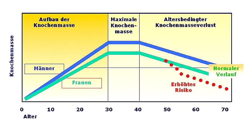 Osteoporose Knochenmasse Knochmasse bei Osteoporose nach Alter