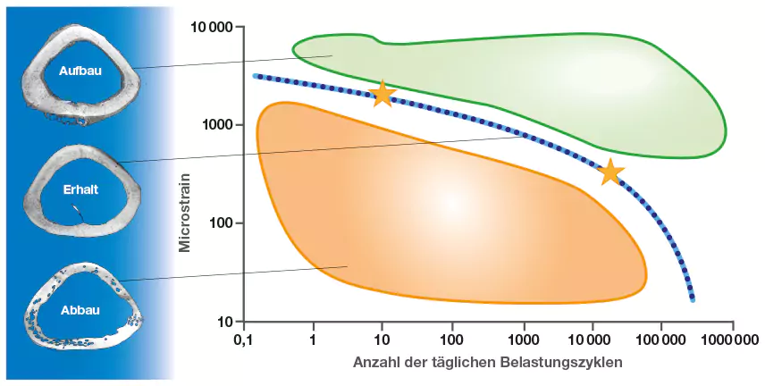Osteoporse Belastung der Knochen bei osteoporose belastung der knochen für mehr knochendichte