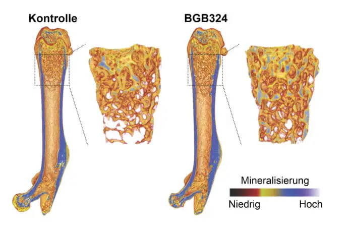 Knochen nach der Behandlung mit BGB324 weist höhere Knochendichte auf